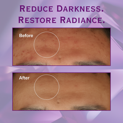 Cenflora™ Tone Brightening Capsule Ampoule – Glow & Calm Serum for Radiant, Even Skin